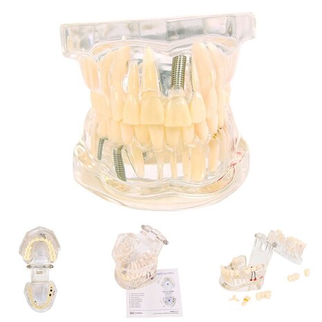 Anatomie model volwassen gebit (transparant)