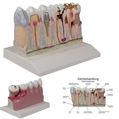 Anatomie model tanden 3 t/m 7, 4x ware grootte