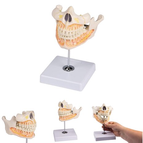 Anatomie model volwassen gebit, 11x11x12 cm