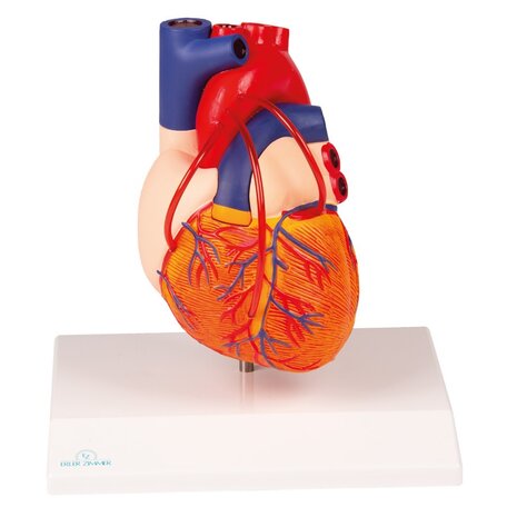 Anatomie model hart met bypasses, 2-delig, 14x8x8 cm