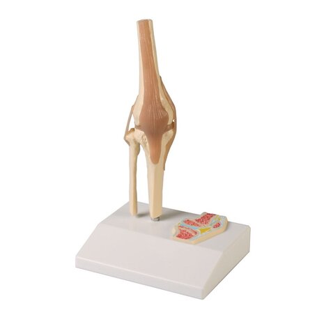 Anatomie model kniegewricht met ligamenten (mini, 12x10x20cm)