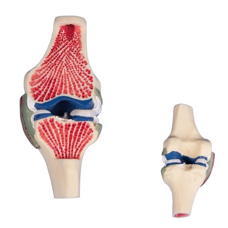 Anatomie model doorsnede van het kniegewricht