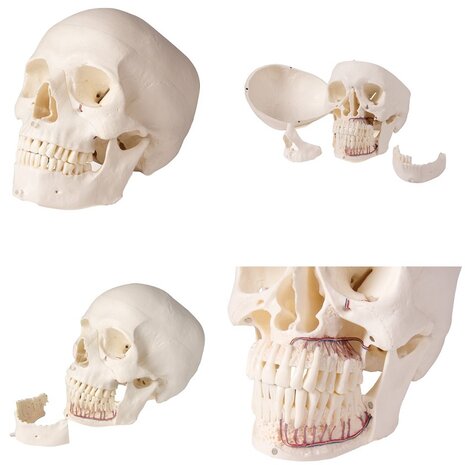 Anatomie model schedel voor tandheelkunde en kaakchirurgie, 5-delig