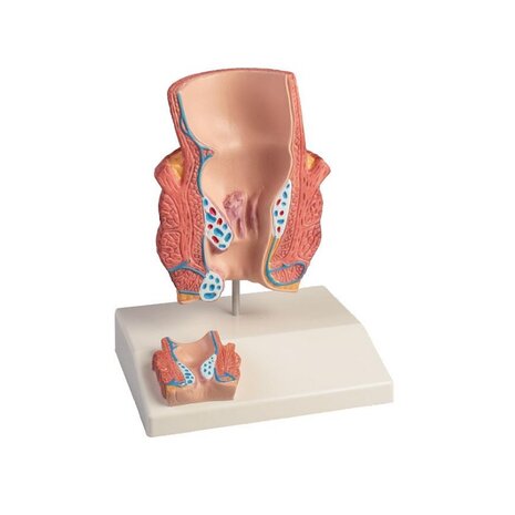 Anatomie model aambeien