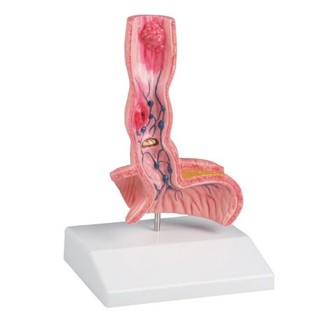 Anatomie model slokdarm