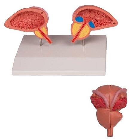 Anatomie model prostaat (2-delig, 20x9x13 cm)