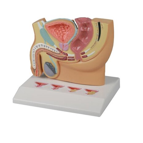 Anatomie model bekkendoorsnede met prostaataandoening