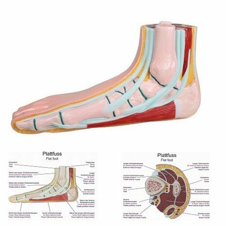 Anatomie model voet (platvoet)