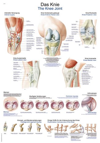 Anatomie poster kniegewricht (kunststof-folie, 70x100 cm)