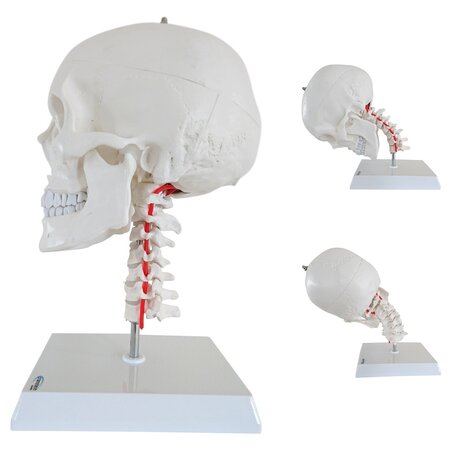 Anatomie model schedel met flexibele cervicale wervelkolom