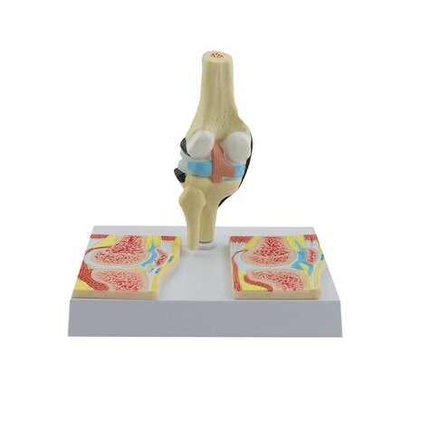 Anatomie model knie met reuma