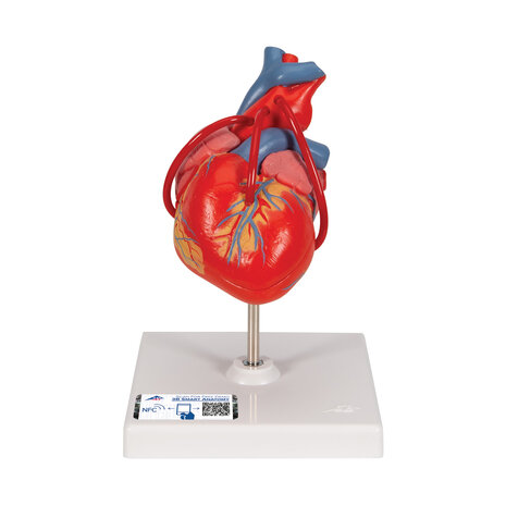 Anatomie model hart met bypass, 2-delig, 19x12x12 cm