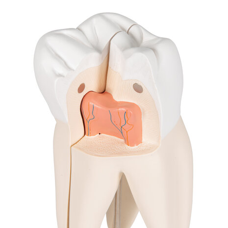 Anatomie model bovenmolaar, 3-delig, 29 cm