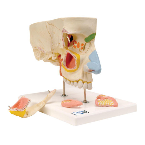 Anatomie model neus met sinussen, 5-delig, 26x19x24 cm