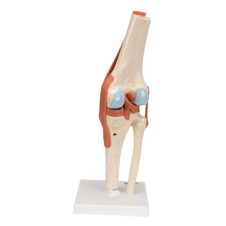 Anatomie model knie met kraakbeen