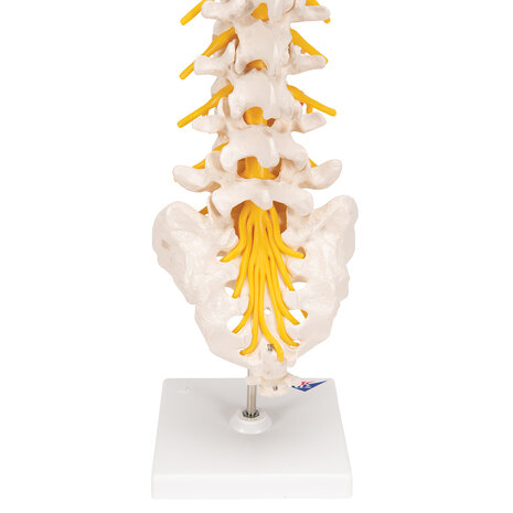 Anatomie model lumbale wervelkolom met hernia