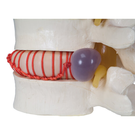 Anatomie model hernia simulator