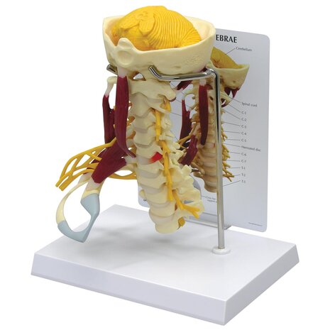 Anatomie model cervicale wervelkolom met spieren