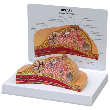 Anatomie model borstweefsel