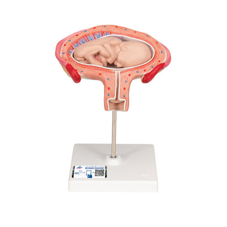 Anatomie model zwangerschap, 4e maand foetus (dwarsligging)