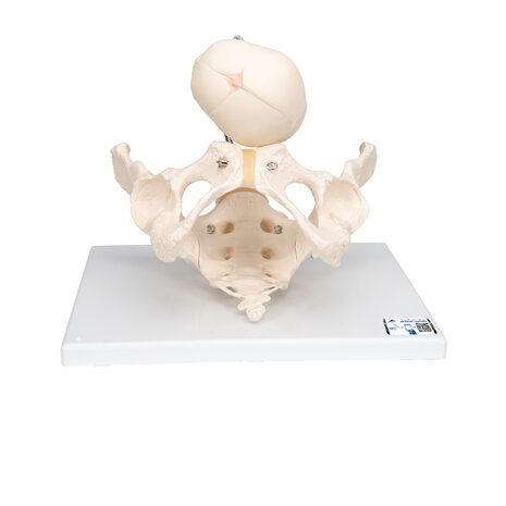 Anatomie model geboorte met schedel van de foetus