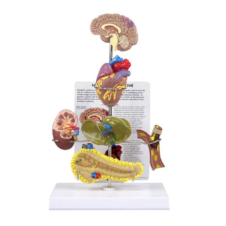 Anatomie model metabool syndroom