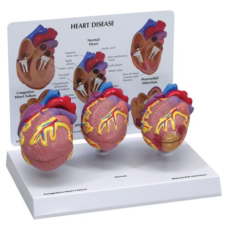 Anatomie model hart, 3 stuks mini