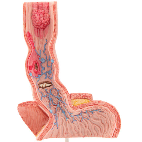 Anatomie model slokdarm